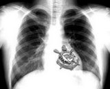 magraum vida loka Logo